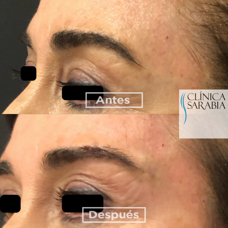 Subida AYD Hilos Foxy eyes 06 11 2020