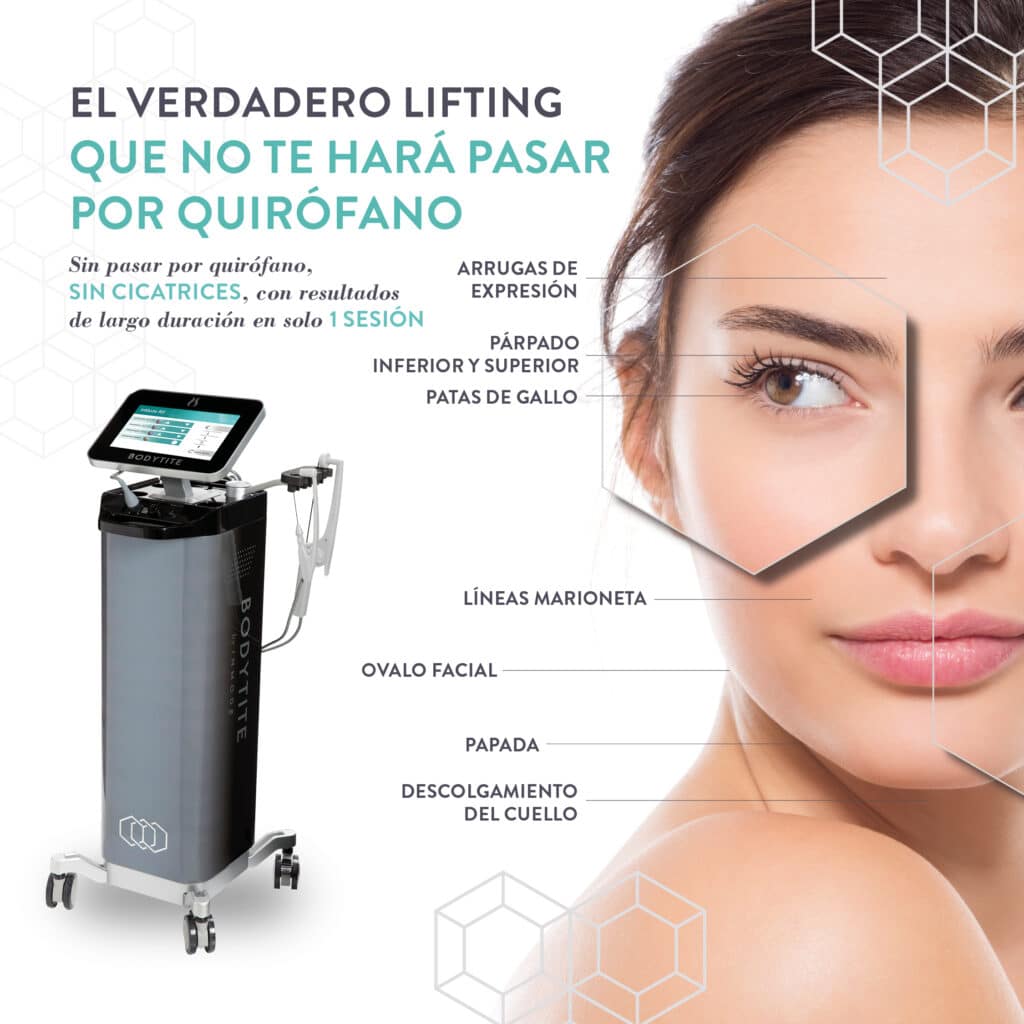 Tratamiento BodyTite facial 1